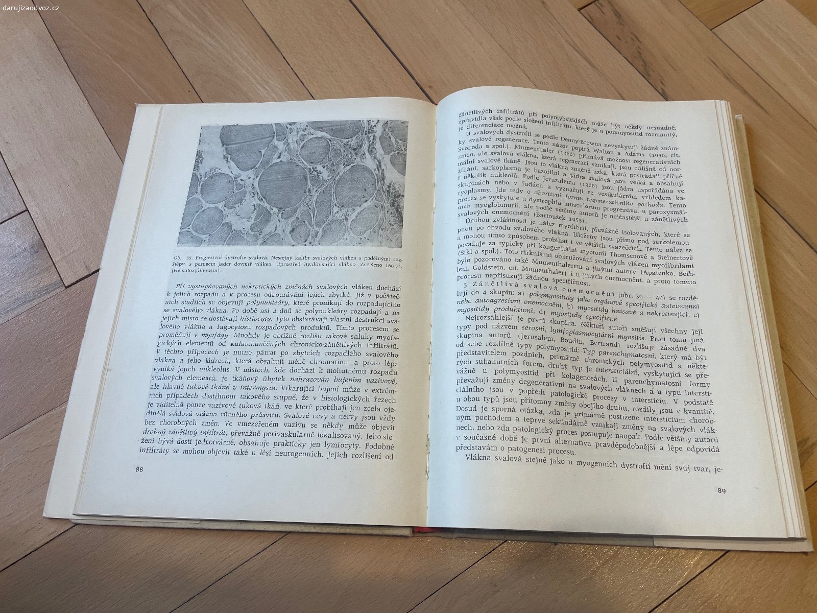 Kniha NEMOCI KOSTERNÍHO SVALSTVA - Mikula, Steidl. Daruji odbornou knihu NEMOCI KOSTERNÍHO SVALSTVA - F. Mikula, L. Steidl a O. Rozhold. Bez vad! Zdravotnické nakladatelství. Vhodné pro VŠ studenty medicíny. K vyzvednutí po předchozí domluvě na Praze 4. Lze zaslat i Zásilkovnou při platbě předem. Daruji další věci za ODVOZ viz. inzeráty!
